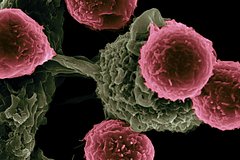 Созданы бактериальные колонии для уничтожения раковых клеток